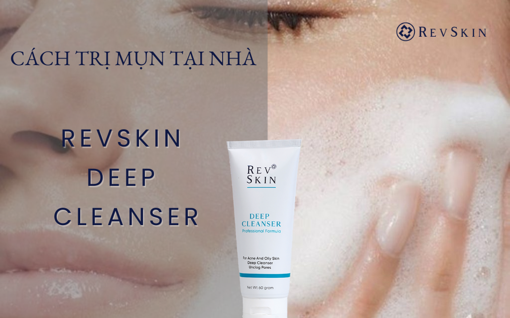 Chuyển giao công nghệ Revskin