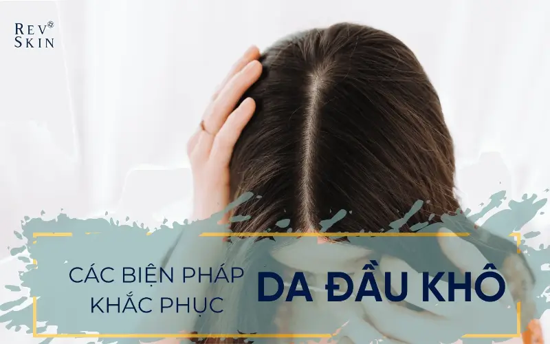 Chuyển giao công nghệ Revskin