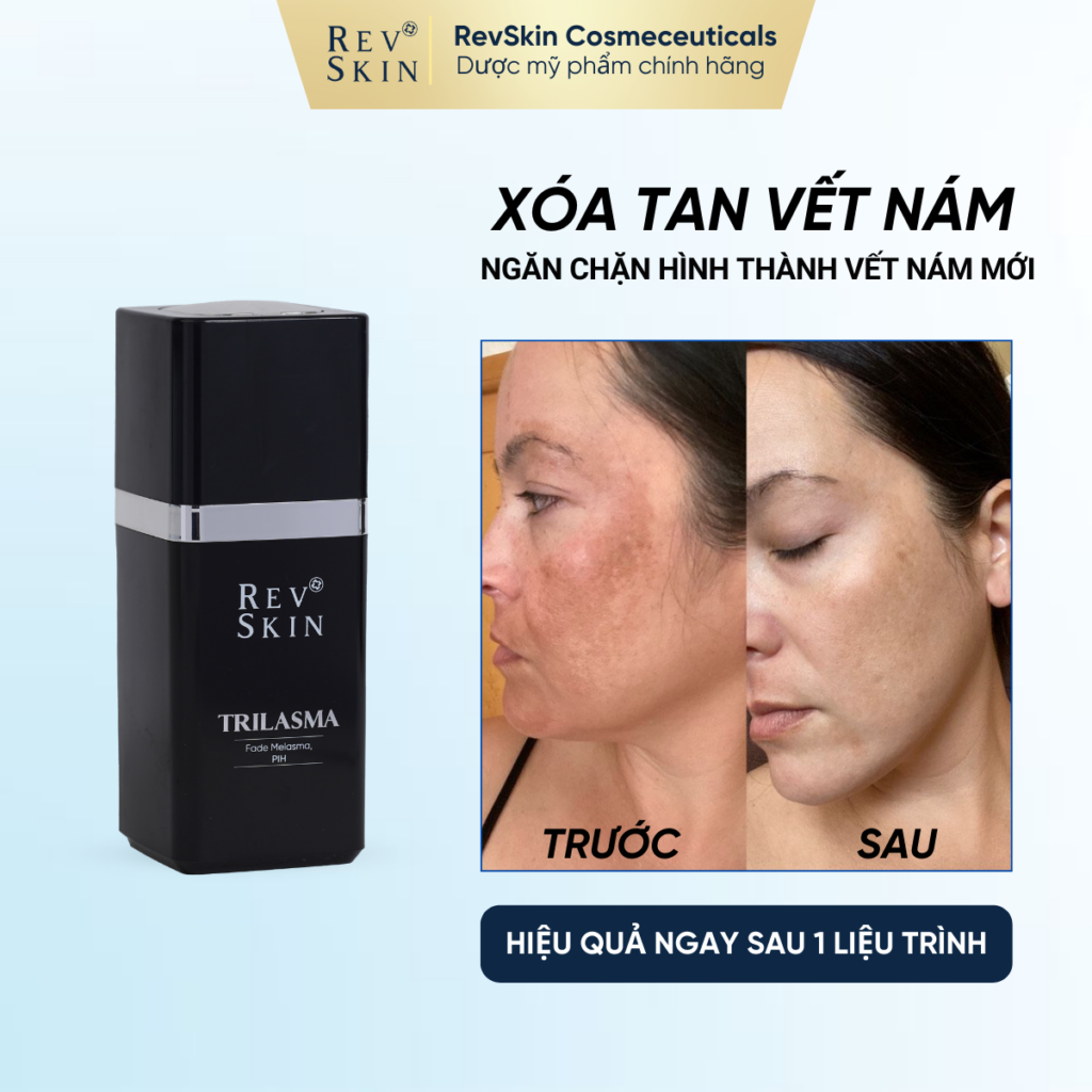 Chuyển giao công nghệ Revskin