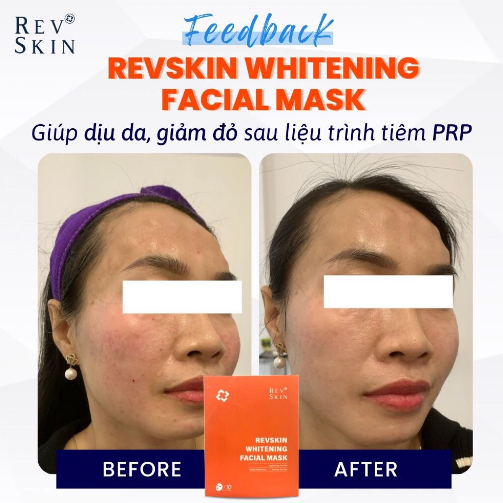 Chuyển giao công nghệ Revskin