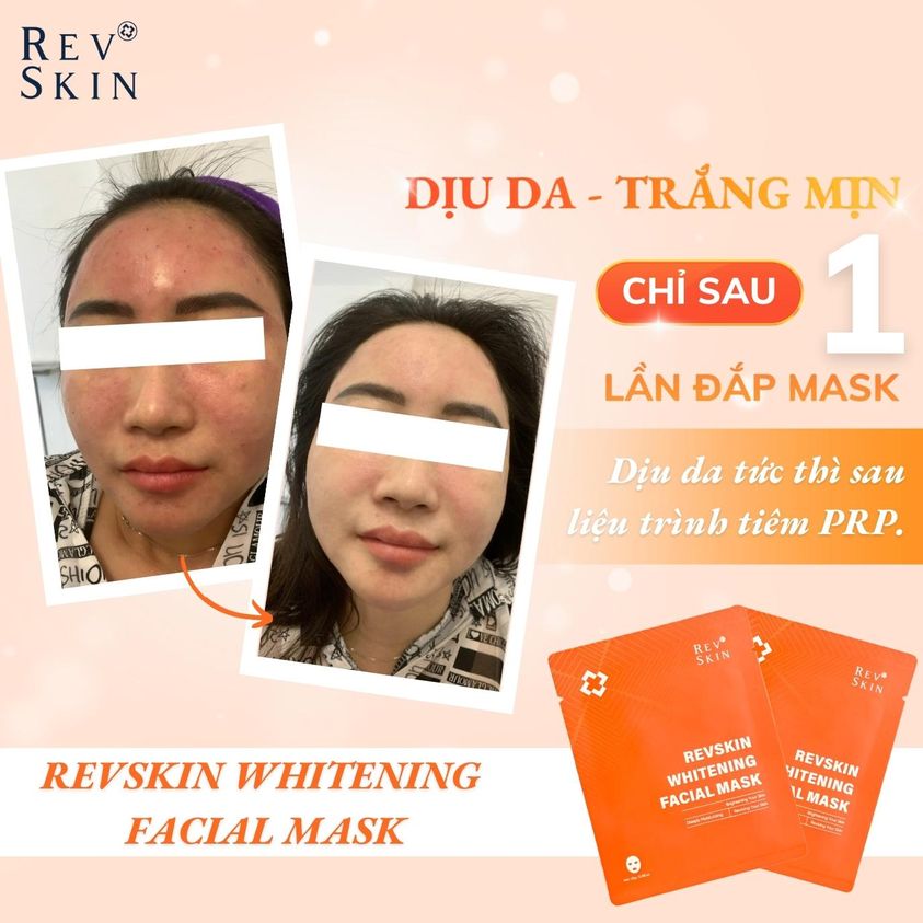 Chuyển giao công nghệ Revskin