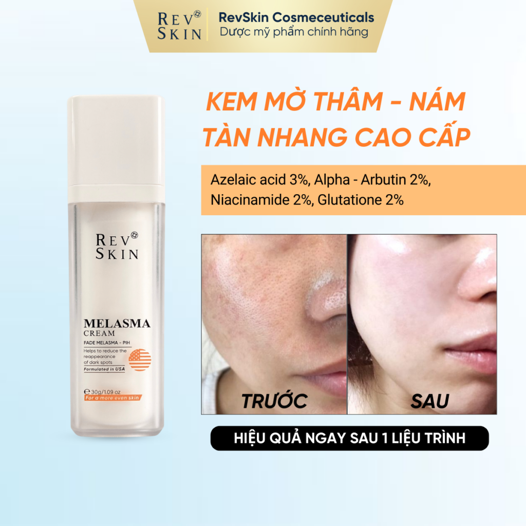 Chuyển giao công nghệ Revskin