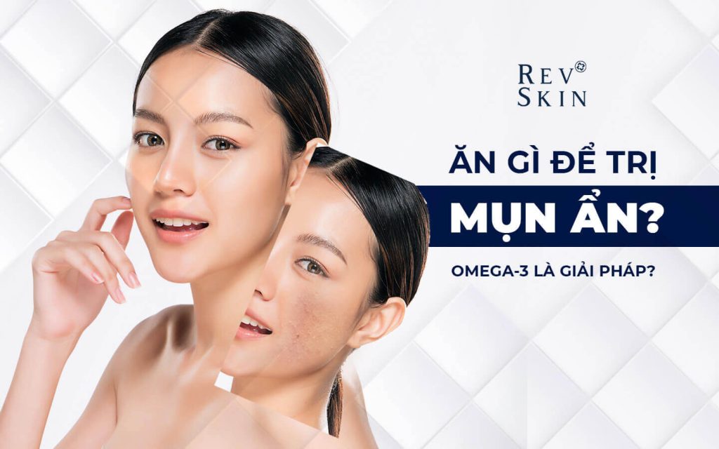 Chuyển giao công nghệ Revskin