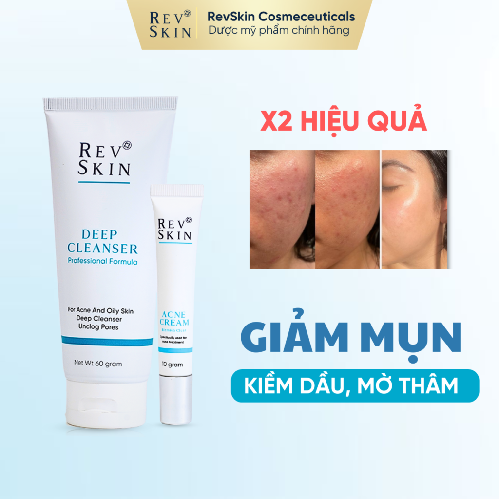 Chuyển giao công nghệ Revskin