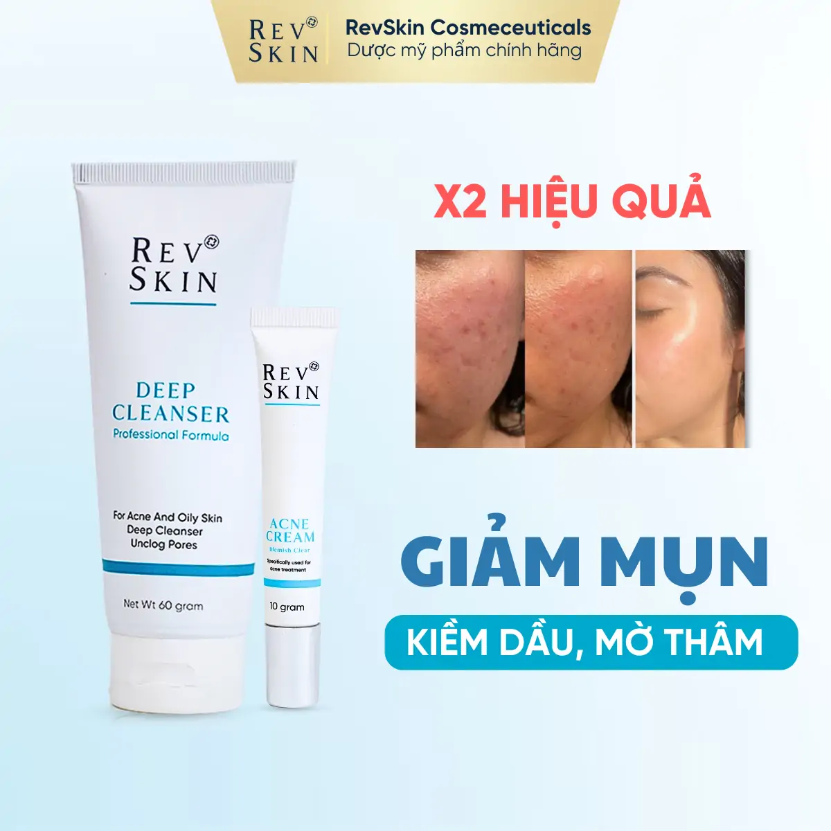 Combo Trị Mụn RevSkin Deep Cleanser & RevSkin Acne Cream ban sao cua anh dong bo shopee thang 6 quynh 2