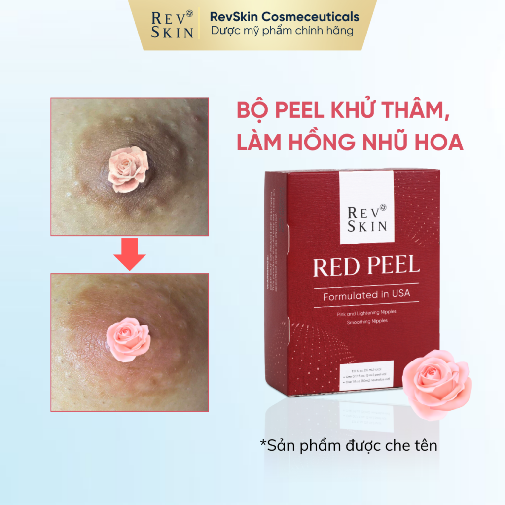 Chuyển giao công nghệ Revskin