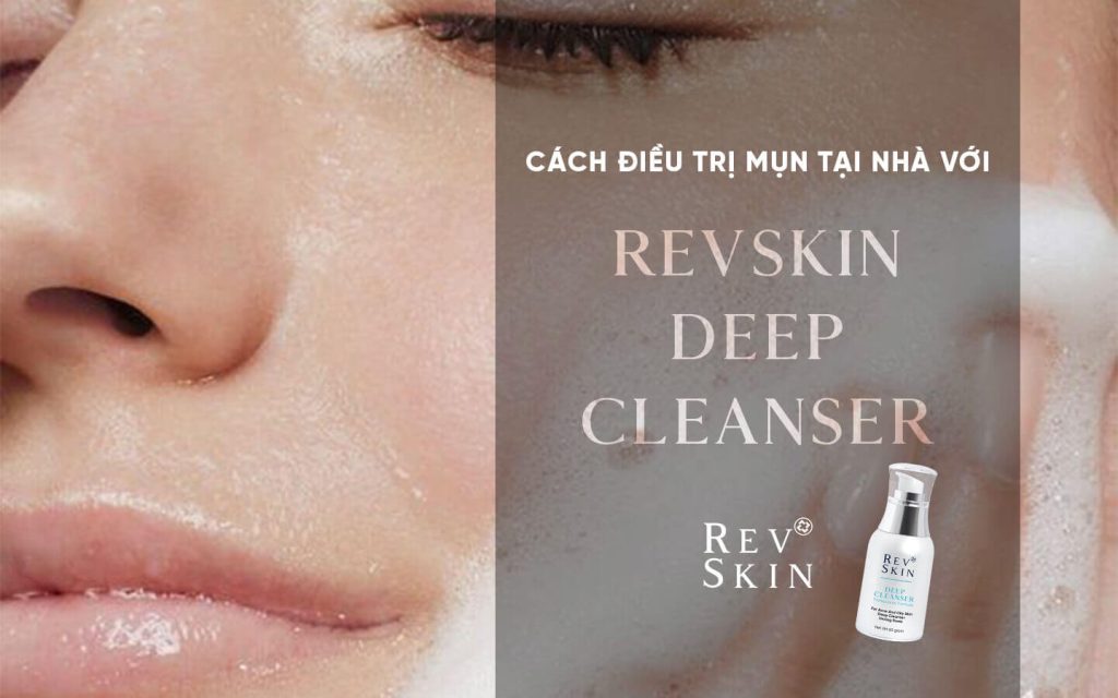 Chuyển giao công nghệ Revskin