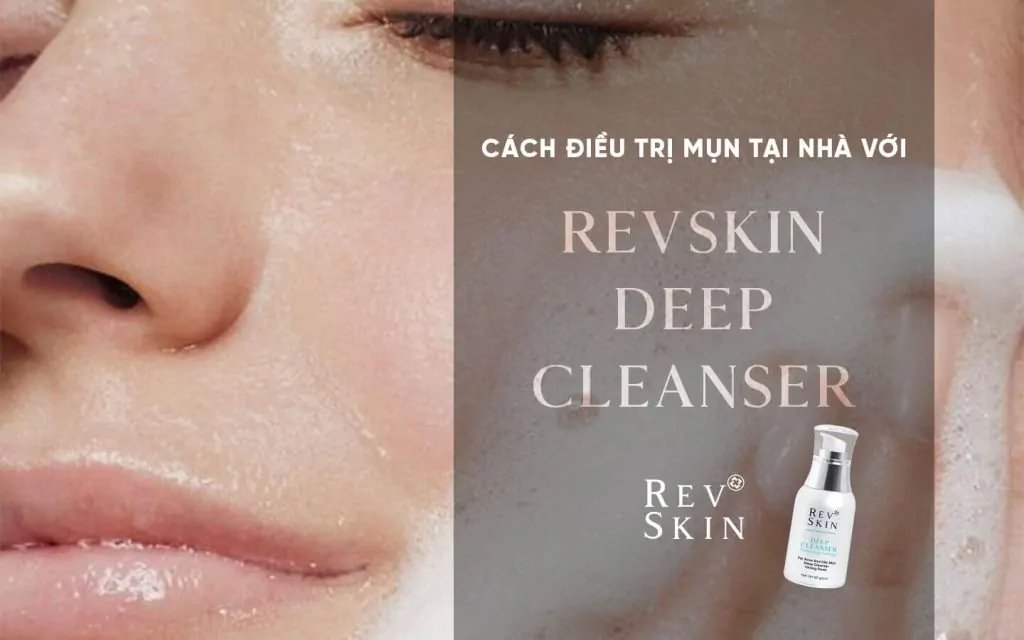 Cách điều trị mụn tại nhà với sữa rửa mặt revskin deep cleanser