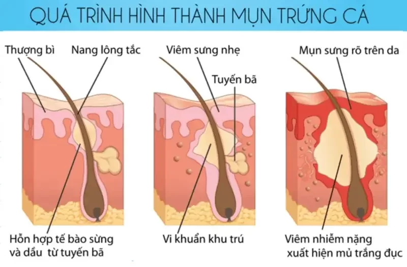 Chuyển giao công nghệ Revskin