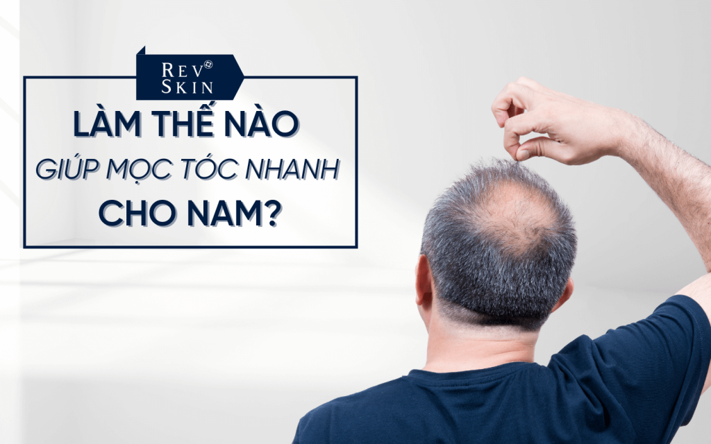 Chuyển giao công nghệ Revskin