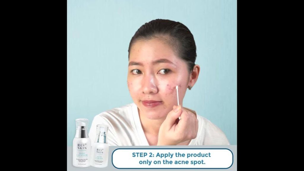 Chuyển giao công nghệ Revskin