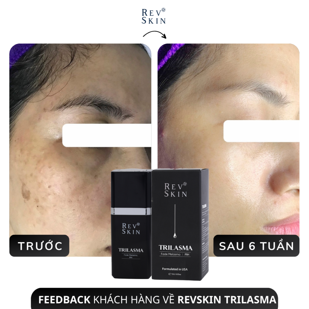 Chuyển giao công nghệ Revskin