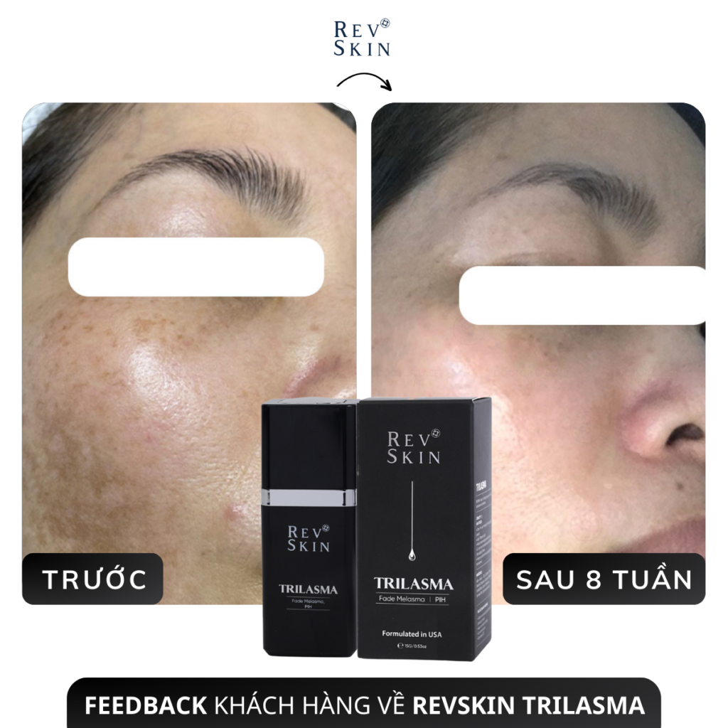 Chuyển giao công nghệ Revskin