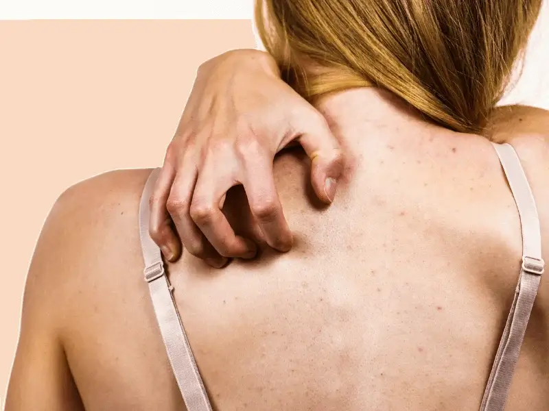 Chuyển giao công nghệ Revskin