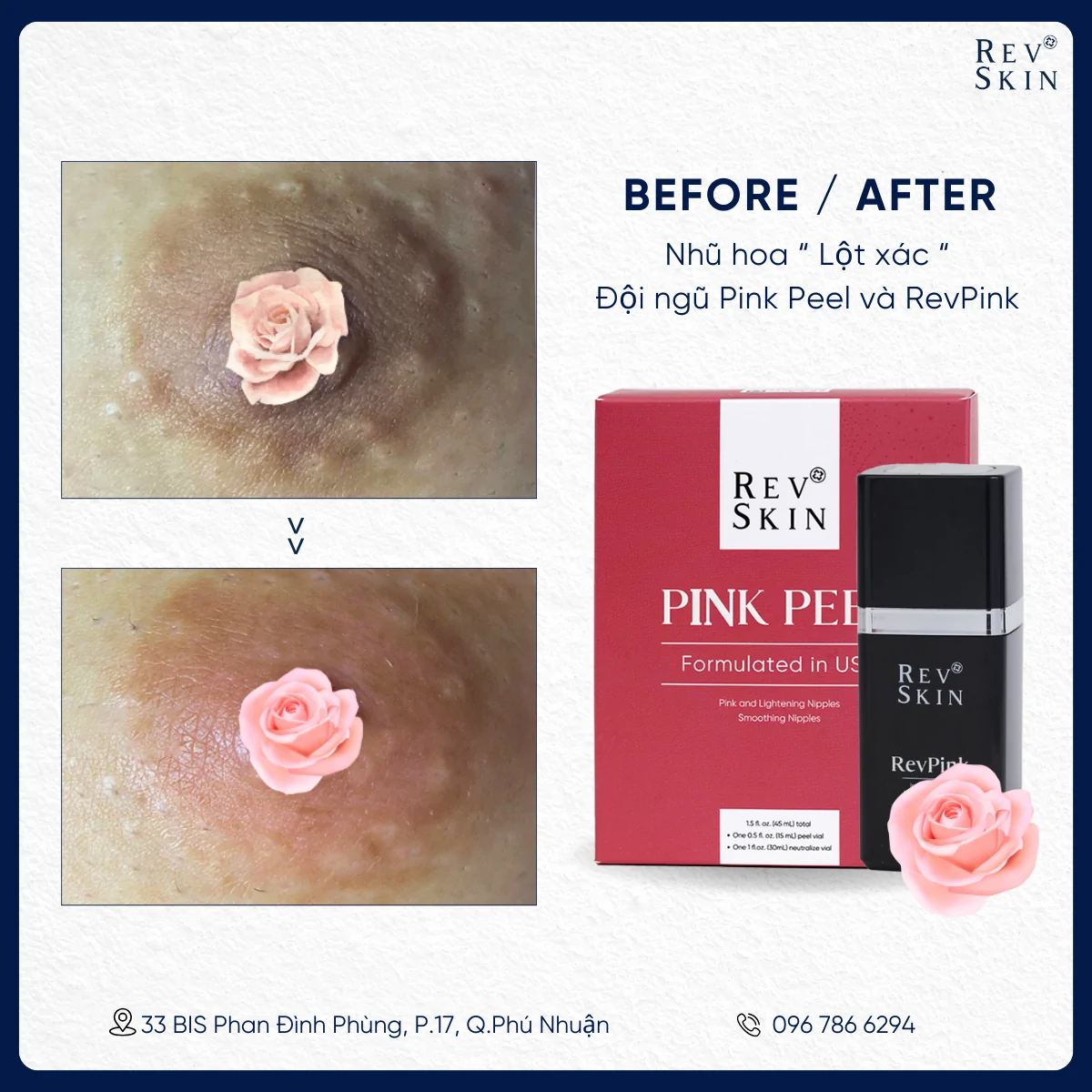 Kem Làm Hồng Giảm Thâm Vùng Nhũ Hoa Revskin Revpink Cream peel da 3