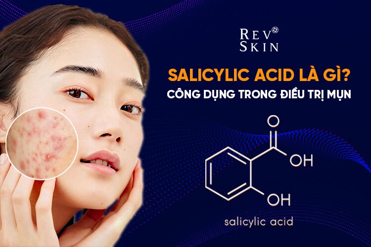 Chuyển giao công nghệ Revskin