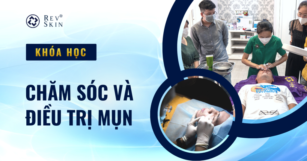 Chuyển giao công nghệ Revskin