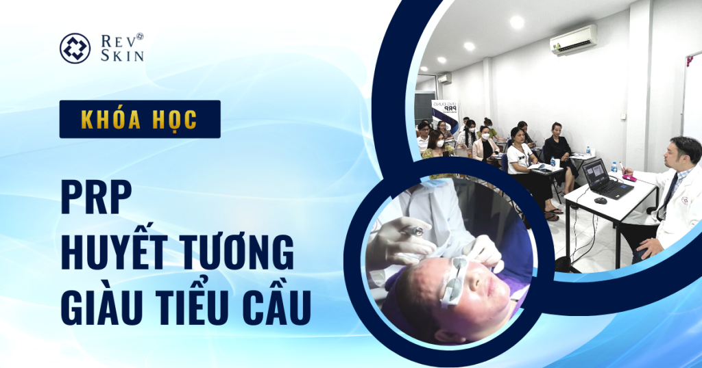 Chuyển giao công nghệ Revskin