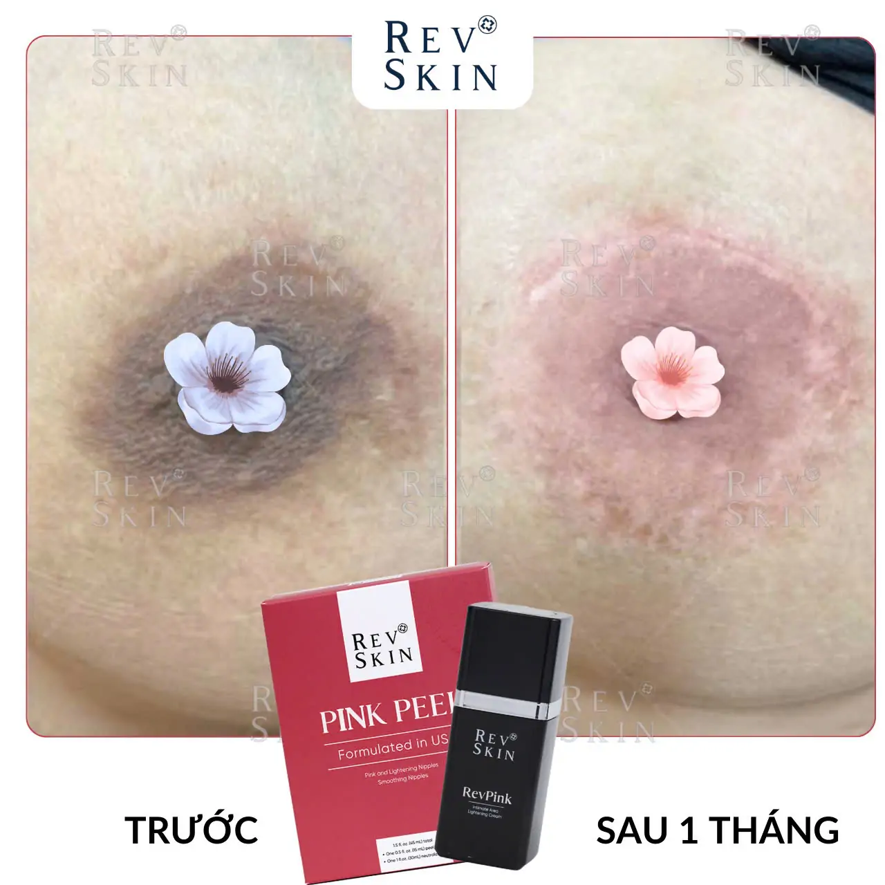 Kem Làm Hồng Giảm Thâm Vùng Nhũ Hoa Revskin Revpink Cream z5992162506719 eec40de06f79b5d4c8a1beab17bb2132