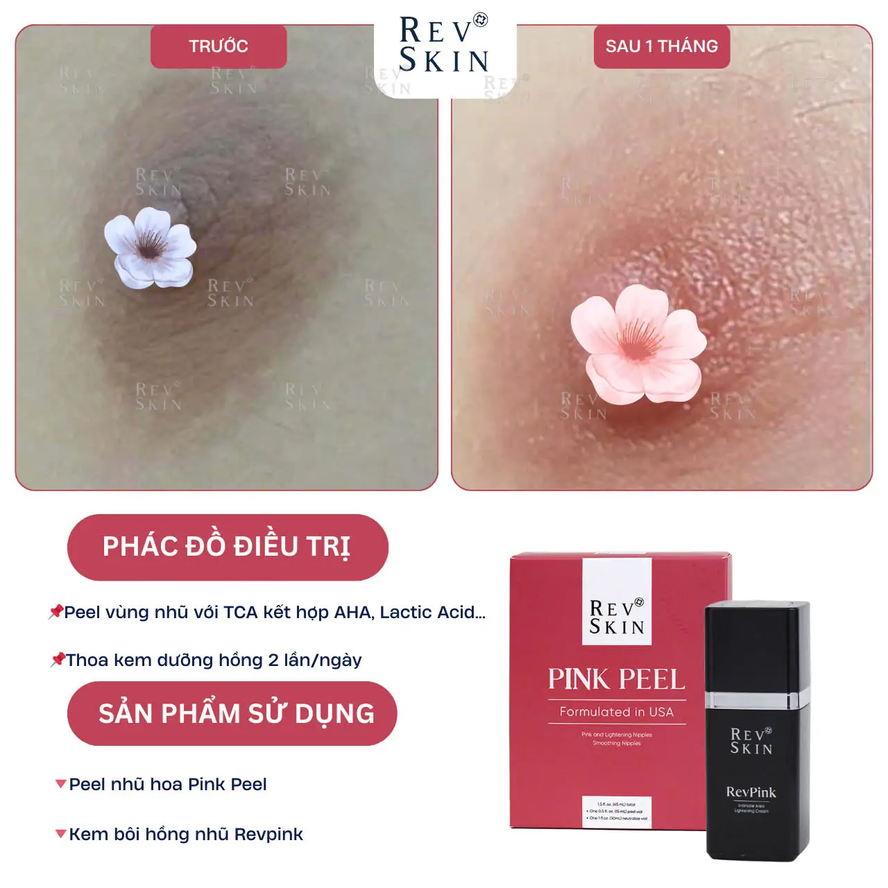Kem Làm Hồng Giảm Thâm Vùng Nhũ Hoa Revskin Revpink Cream z5992162535675 04c5a38dc4314d5d08383cfc19d7999d