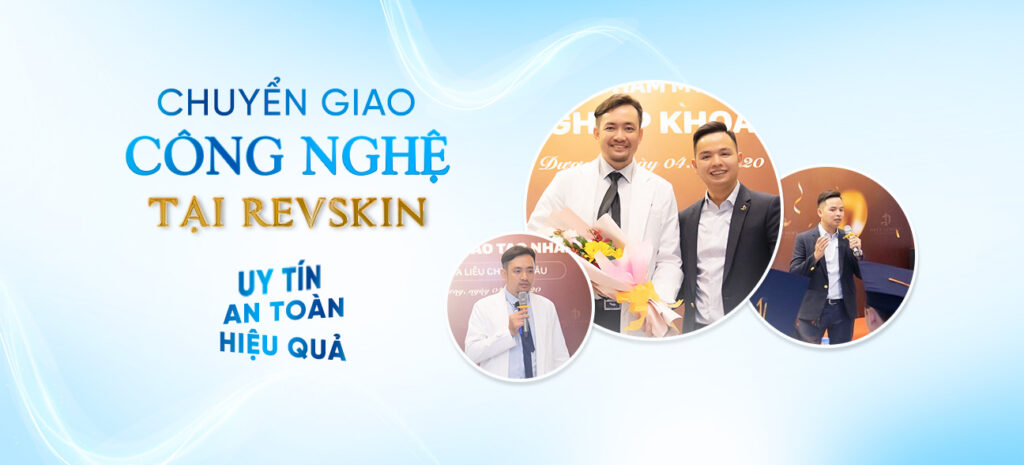 Chuyển giao công nghệ Revskin