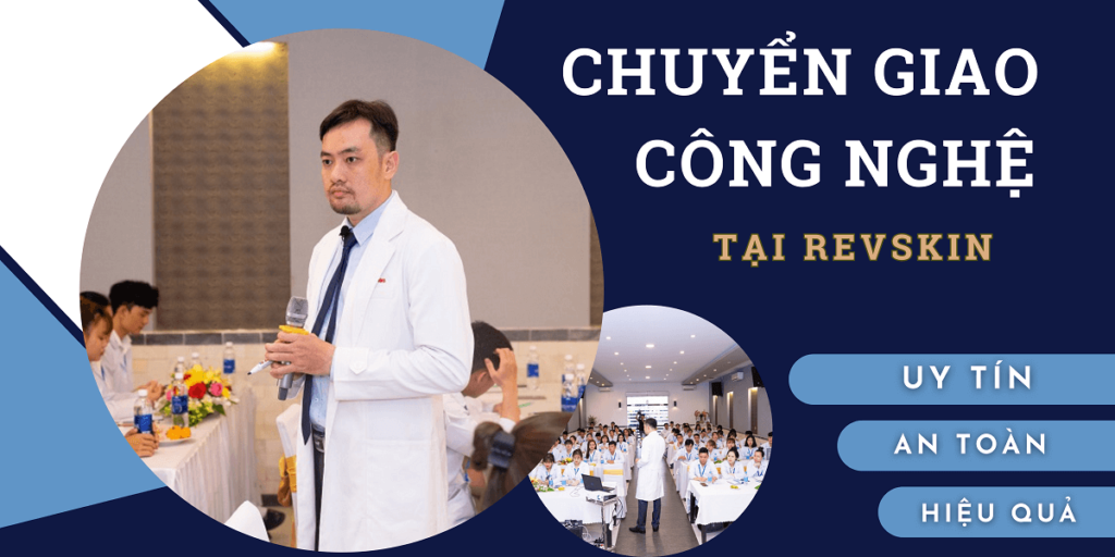 Chuyển giao công nghệ Revskin