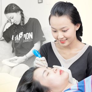 Chuyển giao công nghệ Revskin