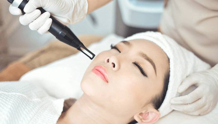 Chuyển giao công nghệ Revskin