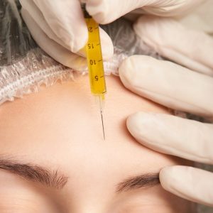 Chuyển giao công nghệ Revskin