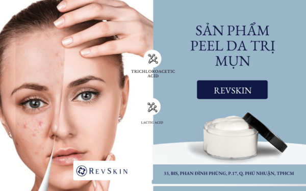 bia peel da mun