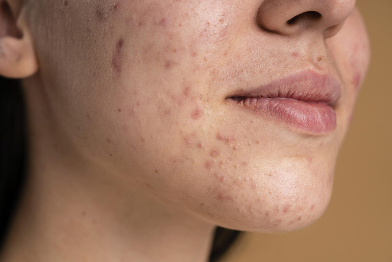 Chuyển giao công nghệ Revskin