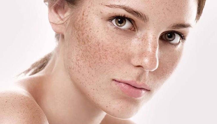 Chuyển giao công nghệ Revskin