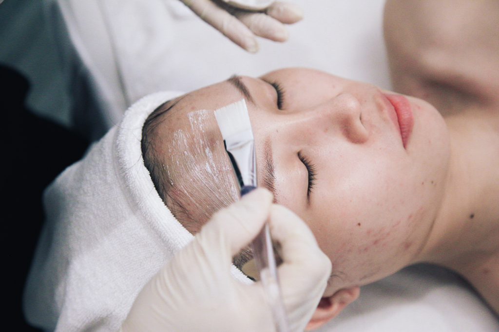 Peel da giúp cải thiện các vấn đề về da