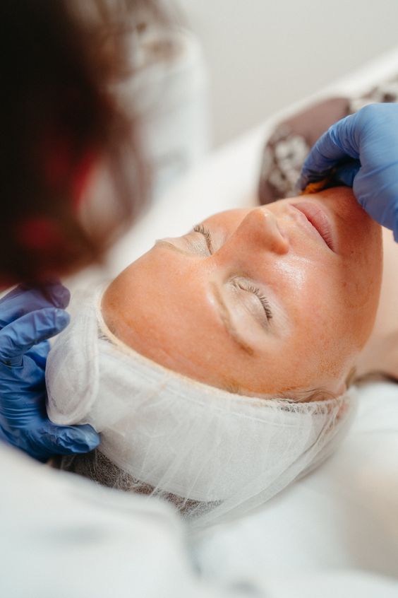 Chuyển giao công nghệ Revskin