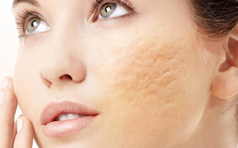 Chuyển giao công nghệ Revskin