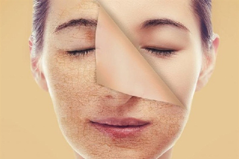 Peel da có công dụng tẩy tế bào chết và sản sinh tế bào mới cho da