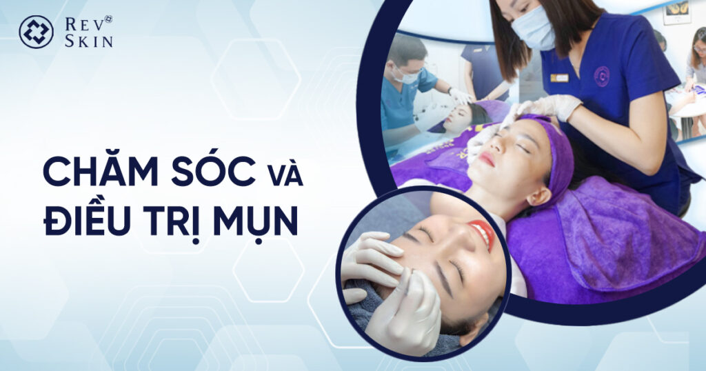 Chuyển giao công nghệ Revskin