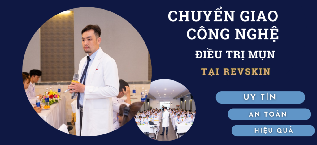 Chuyển giao công nghệ Revskin