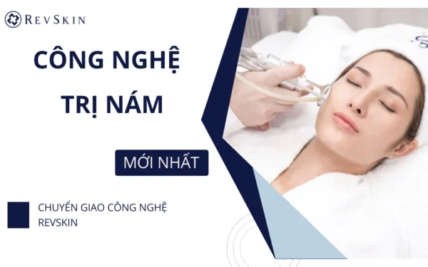 Công nghệ điều trị nám mới nhất