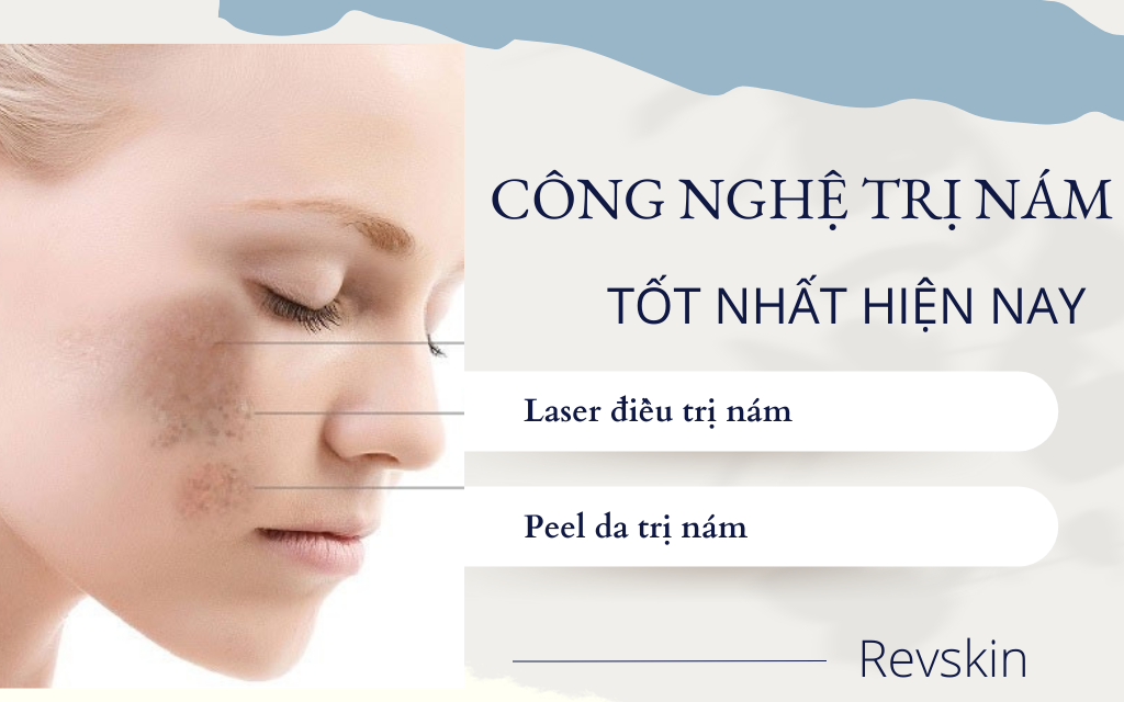 Chuyển giao công nghệ Revskin