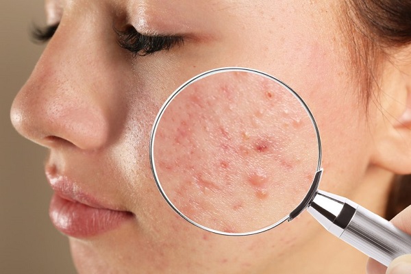 Chuyển giao công nghệ Revskin