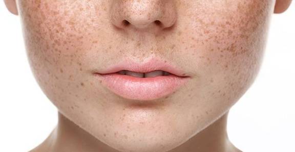 Chuyển giao công nghệ Revskin