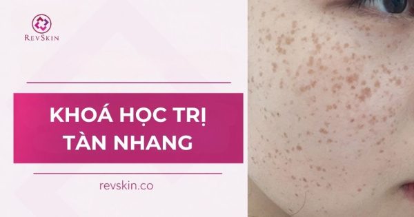 khóa học trị tàn nhang