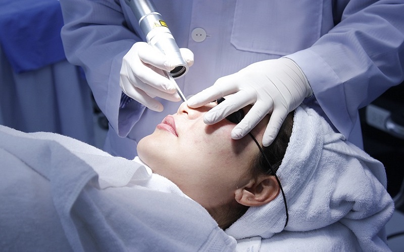 Chuyển giao công nghệ Revskin