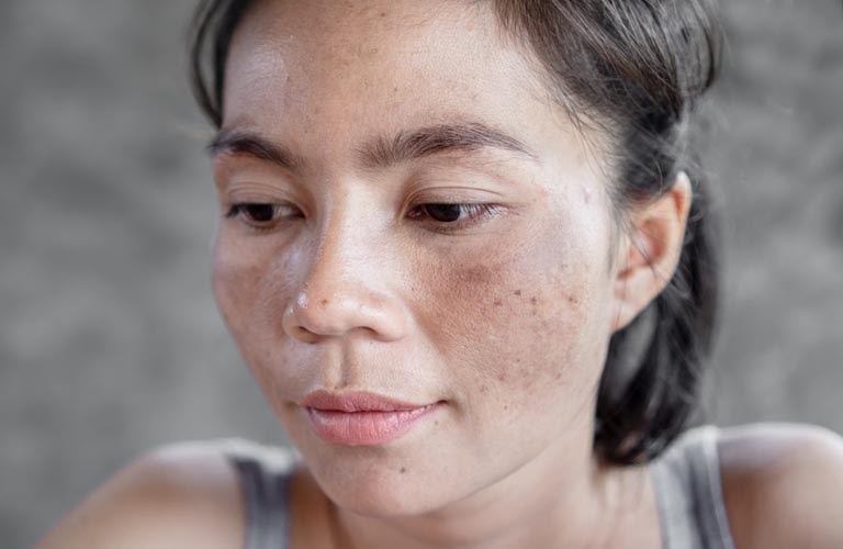 Chuyển giao công nghệ Revskin
