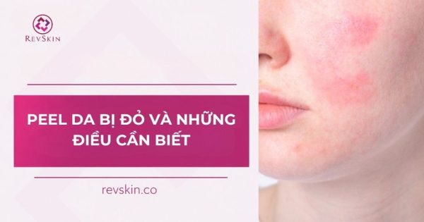 peel da bị đỏ và những điều cần biết