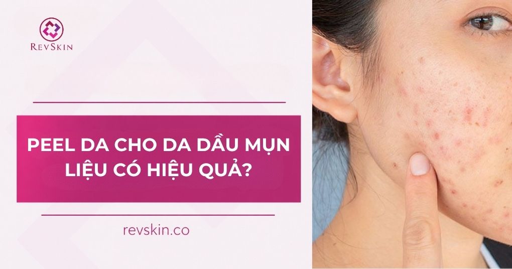 Chuyển giao công nghệ Revskin