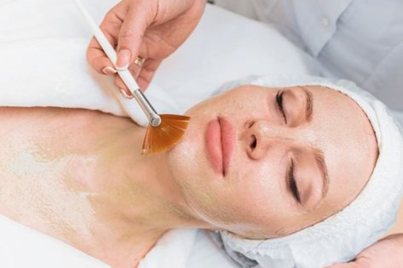 Chuyển giao công nghệ Revskin