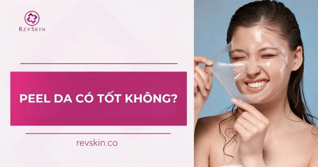 Peel da có tốt không vẫn là câu hỏi của nhiều người peel da có tốt không vẫn là câu hỏi của nhiều người