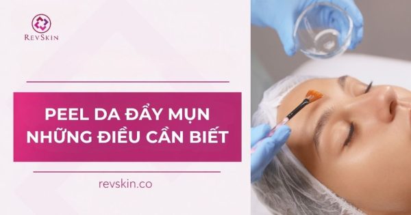 peel da đẩy mụn và những điều cần biết